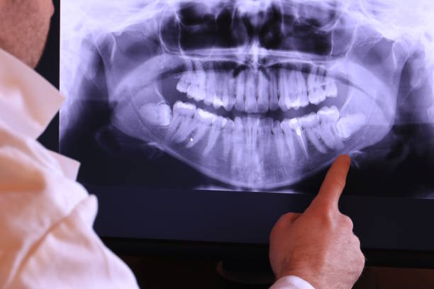 Best Dental Abscess Treatment in Highland Park, TX